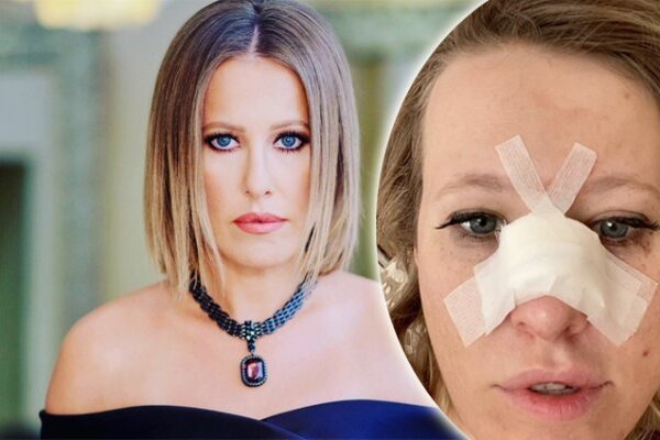 Собчак оказала большую услугу Кремлю