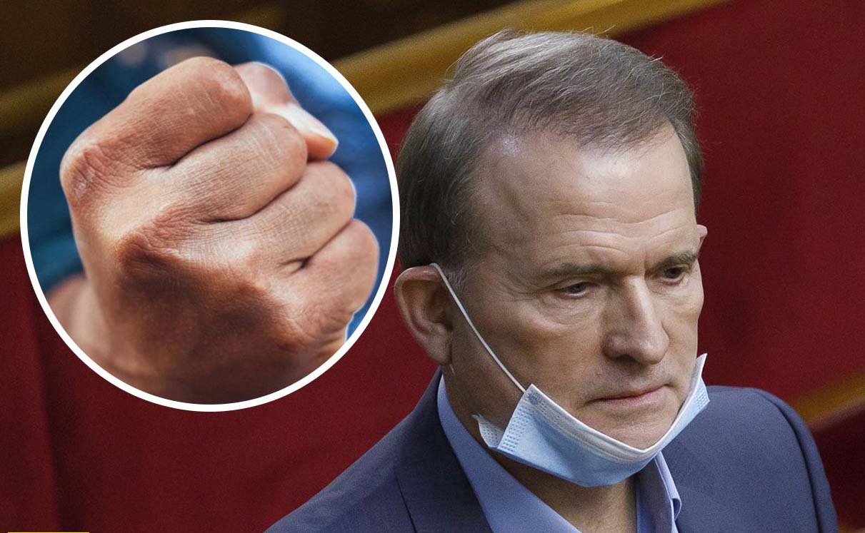 "Он никогда не просил прощения": журналисты нашли мужчину, которого избил Медведчук